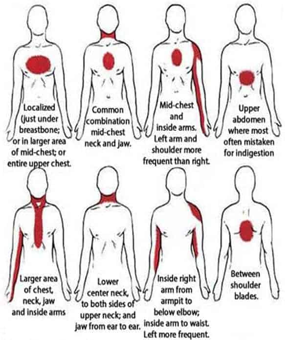 Infographic on cardiac arrest symptoms