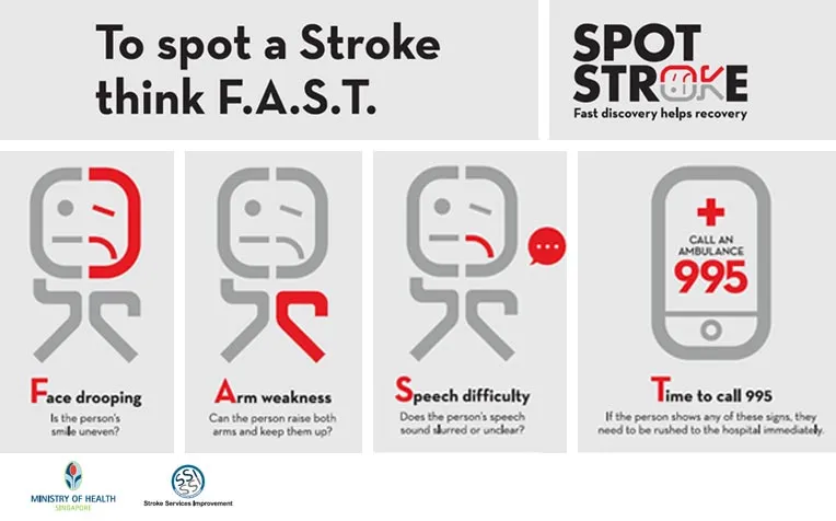 To spot a Stroke