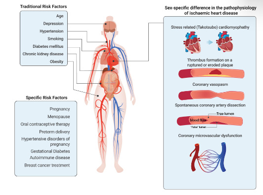 Faktor risiko penyakit jantung koroner kronis pada wanita