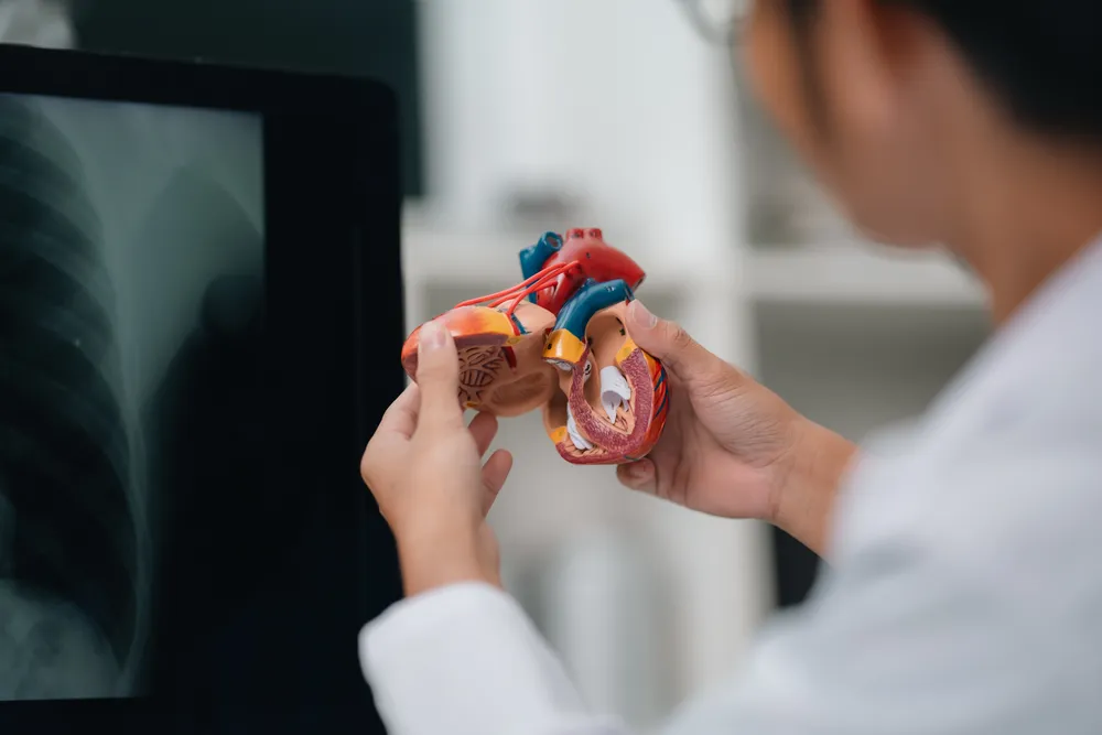 Arrhythmia: Understanding Irregular Heart Rhythms